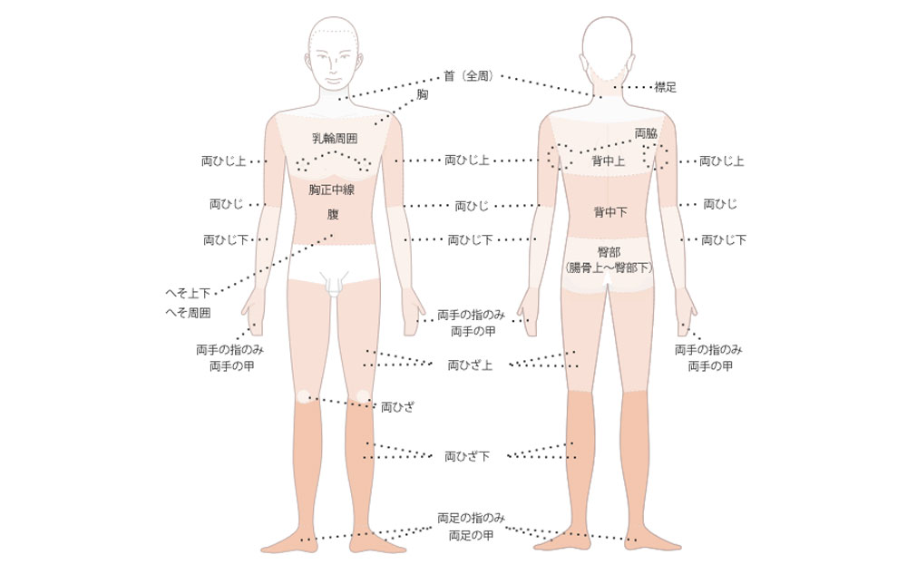 部位と費用