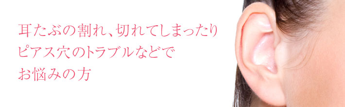耳たぶの割れ、切れてしまったりピアス穴のトラブルなどでお悩みの方