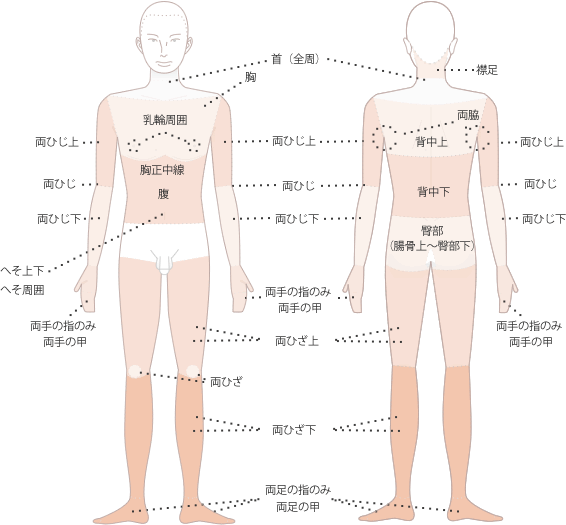 脱毛部位表【ボディ】