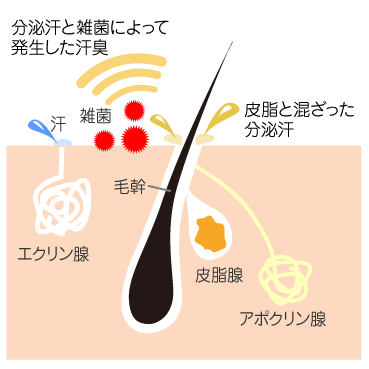 ワキのニオイが気になりませんか？